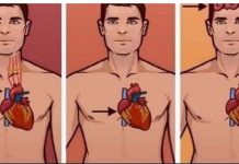 1 ZNAK NA KOŽI UKAZUJE DA JE VAŠE SRCE U LOŠEM STANJU: Ako ovo primijetite javite se doktoru ODMAH! 1 ZNAK NA KOŽI UKAZUJE DA JE VAŠE SRCE U LOŠEM STANJU: Ako ovo primijetite javite se doktoru ODMAH! - featured image