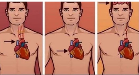 1 ZNAK NA KOŽI UKAZUJE DA JE VAŠE SRCE U LOŠEM STANJU: Ako ovo primijetite javite se doktoru ODMAH! - featured image 1 ZNAK NA KOŽI UKAZUJE DA JE VAŠE SRCE U LOŠEM STANJU: Ako ovo primijetite javite se doktoru ODMAH! - featured image