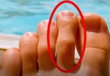 DOBRO POGLEDAJTE PRSTE NA NOGAMA: Ukoliko je drugi prst duži od ostalih, to nije SLUČAJNO! DOBRO POGLEDAJTE PRSTE NA NOGAMA: Ukoliko je drugi prst duži od ostalih, to nije SLUČAJNO! - featured image