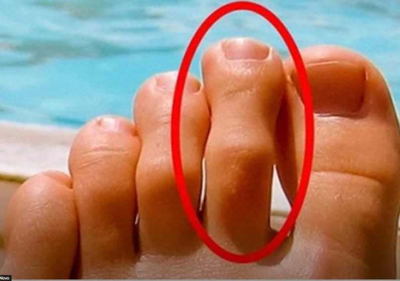 DOBRO POGLEDAJTE PRSTE NA NOGAMA: Ukoliko je drugi prst duži od ostalih, to nije SLUČAJNO! - featured image