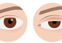 Spušteni kapak i nepodnošljiva glavobolja: Oprez, doktori upozoravaju na 2 alarmantna znaka opasnog stanja