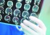 Moždani udar dolazi sa najavom: Ako primetite ove znakove, hitno se javite lekaru Moždani udar dolazi sa najavom: Ako primetite ove znakove, hitno se javite lekaru - featured image
